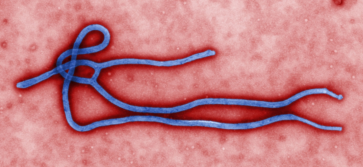 Digitally-colorized, transmission electron microscopic image which demonstrates the filamentous, branching structure of an Ebola virus particle.