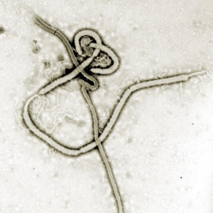 Ebola as seen under a microscope.